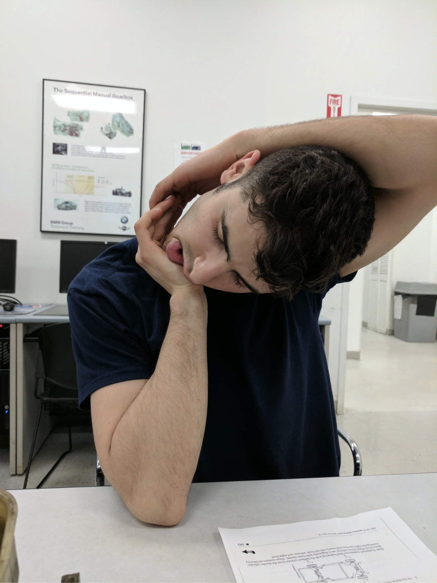 My Typical Migraine Symptoms